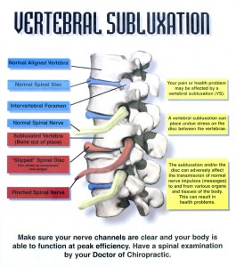 SpencerChiro-Subluxation-web